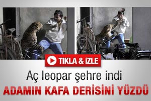 Leopar adamın kafa derisini yüzdü - Video