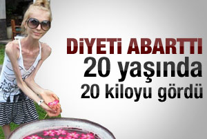 Rus kız zayıflamayı abarttı