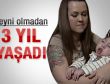 Beyni olmadan 3 yıl yaşadı