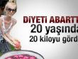 Rus kız zayıflamayı abarttı